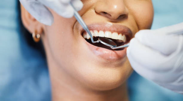 Best Emergency Tooth Extraction in Terra Bella, CA