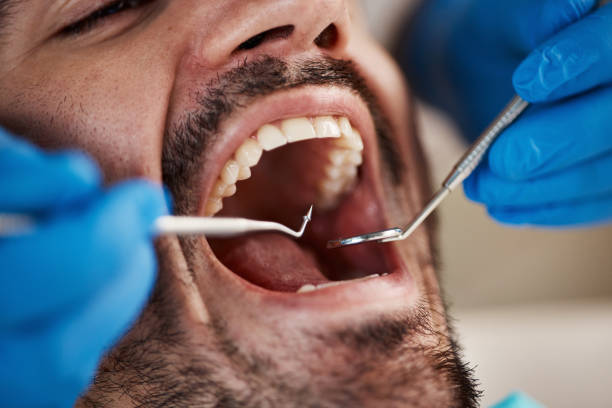 Best Emergency Denture Repair in Terra Bella, CA