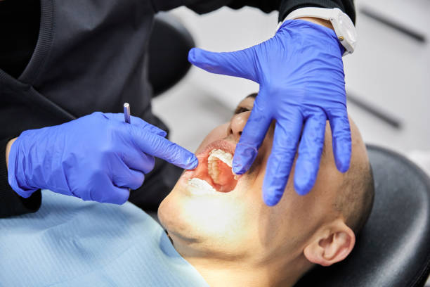 Best Emergency Dental Care for Broken or Chipped Teeth in Terra Bella, CA